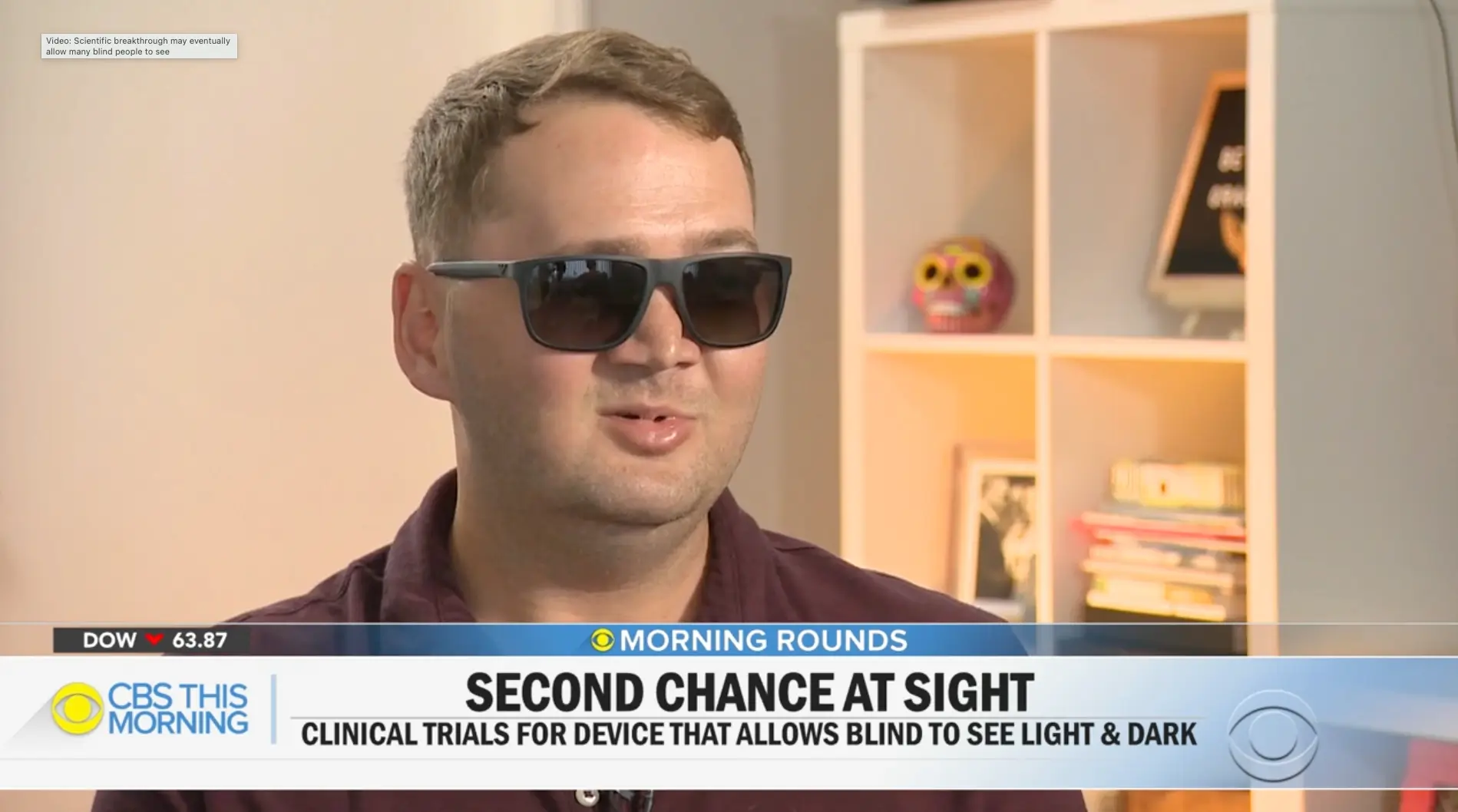 Second Chance At Sight - CBS This Morning screenshot